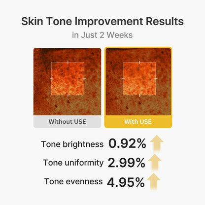 Kojic Acid Turmeric Vita Capsule Cream